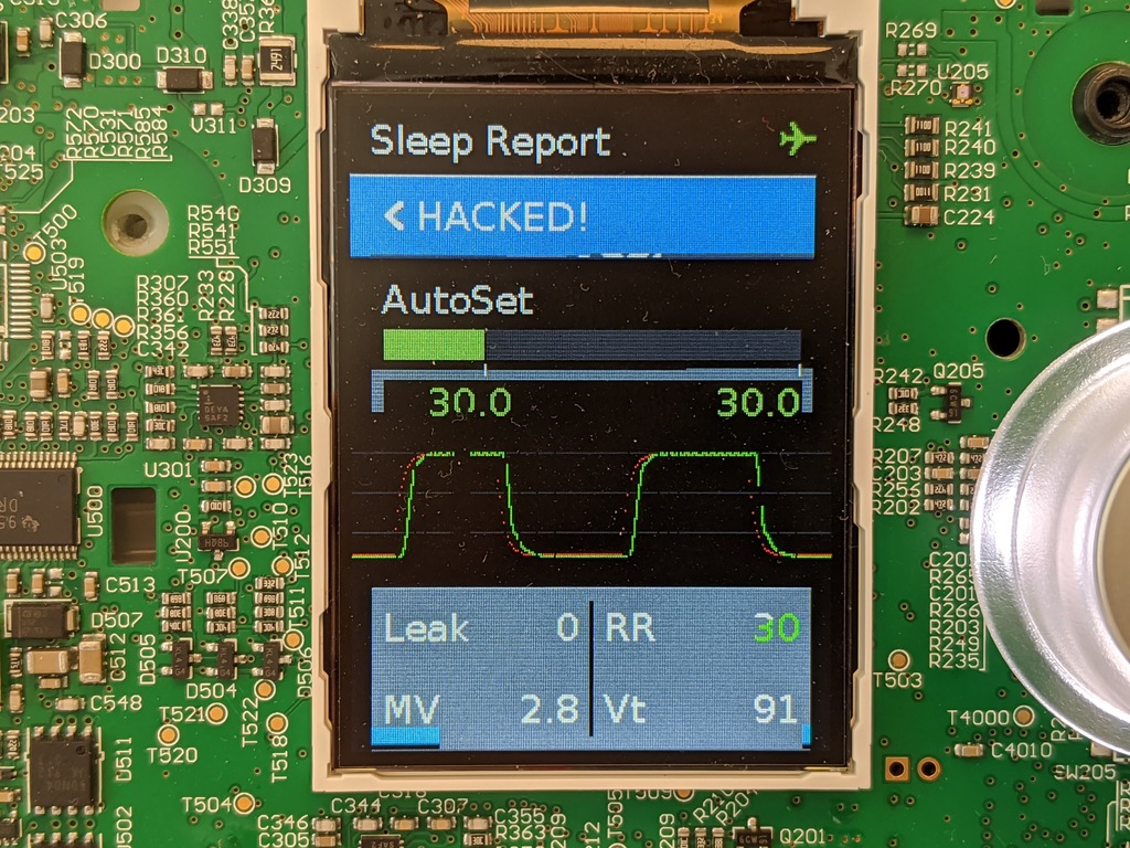 CPAP machine with custom firmware